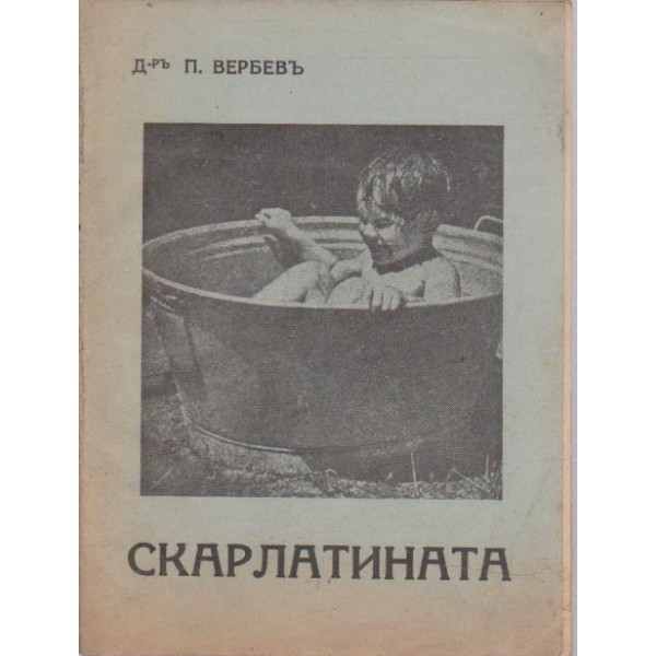 Скарлатината