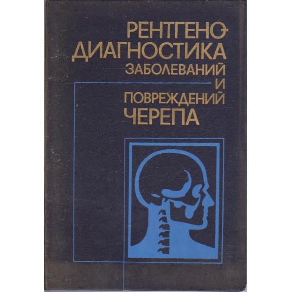 Рентгено диагностика заболеваний и повреждений черепа